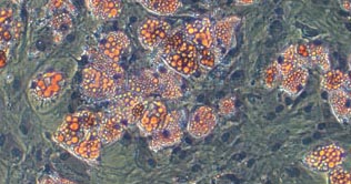 Stem cell pioneers among Nobel Prize candidates